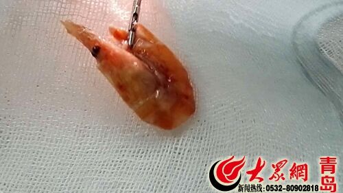 红壳虾和青壳虾哪个好吃_咳嗽半年肺呛入虾壳_呛虾用的是什么虾